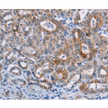 Immunohistochemistry - CASC3 Antibody from Signalway Antibody (36311) - Antibodies.com