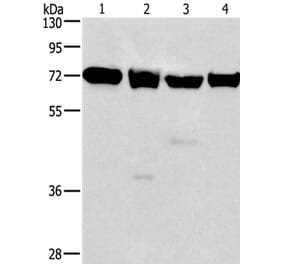 IL2RB Antibody from Signalway Antibody (36318) - Antibodies.com