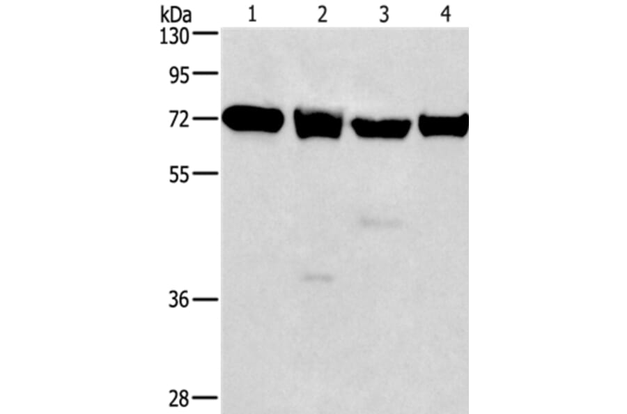IL2RB Antibody from Signalway Antibody (36318) - Antibodies.com
