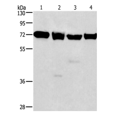 IL2RB Antibody from Signalway Antibody (36318) - Antibodies.com