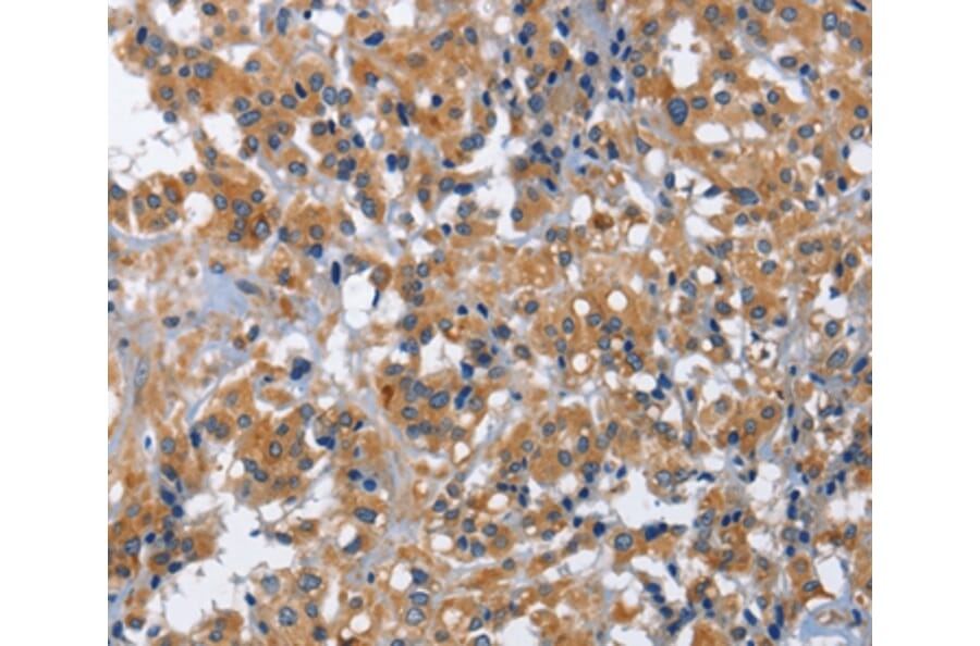 Immunohistochemistry - IL2RB Antibody from Signalway Antibody (36318) - Antibodies.com