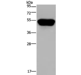 CD160 Antibody from Signalway Antibody (36322) - Antibodies.com
