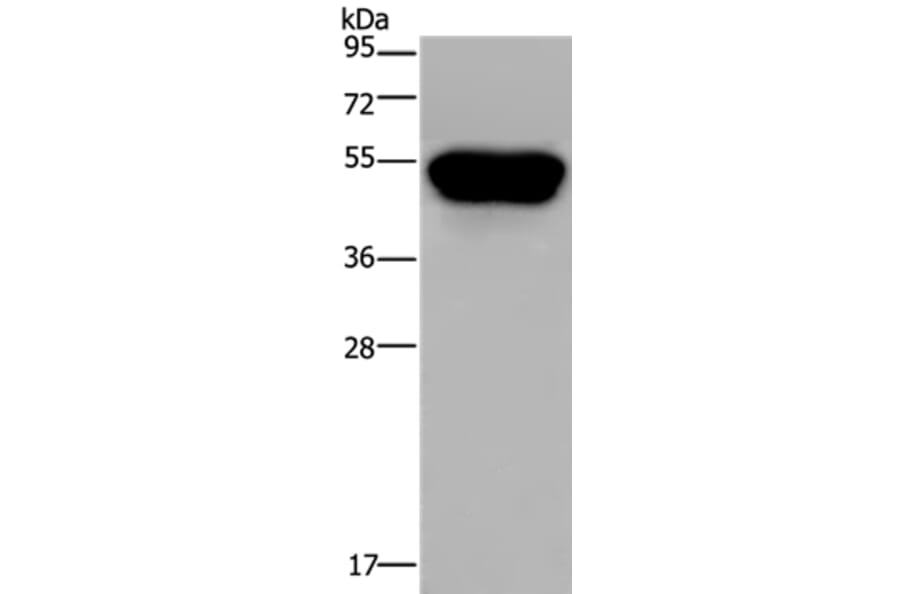 CD160 Antibody from Signalway Antibody (36322) - Antibodies.com