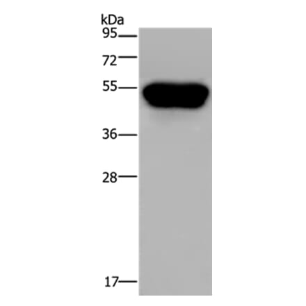 CD160 Antibody from Signalway Antibody (36322) - Antibodies.com