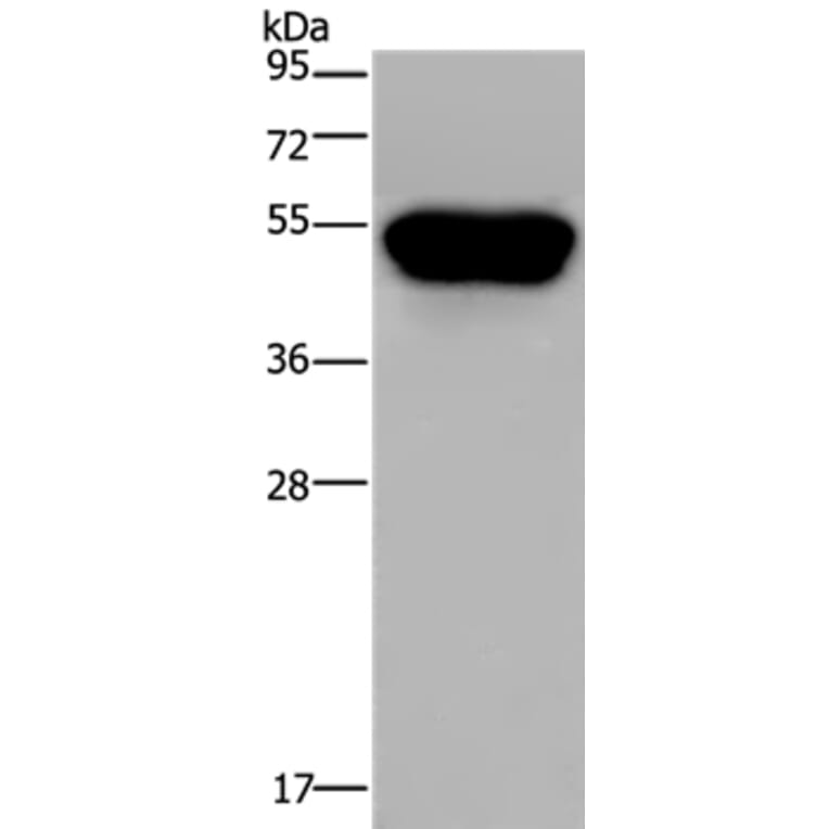 CD160 Antibody from Signalway Antibody (36322) - Antibodies.com