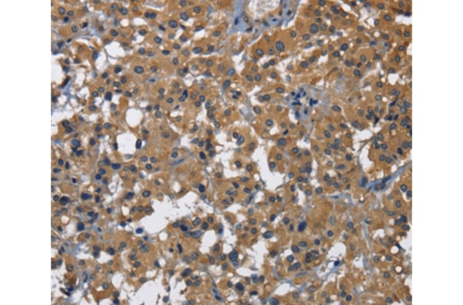 Immunohistochemistry - CD160 Antibody from Signalway Antibody (36322) - Antibodies.com