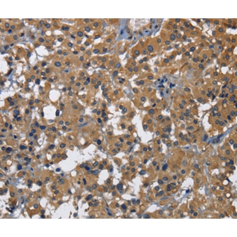 Immunohistochemistry - CD160 Antibody from Signalway Antibody (36322) - Antibodies.com