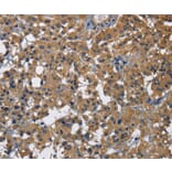 Immunohistochemistry - CD160 Antibody from Signalway Antibody (36322) - Antibodies.com