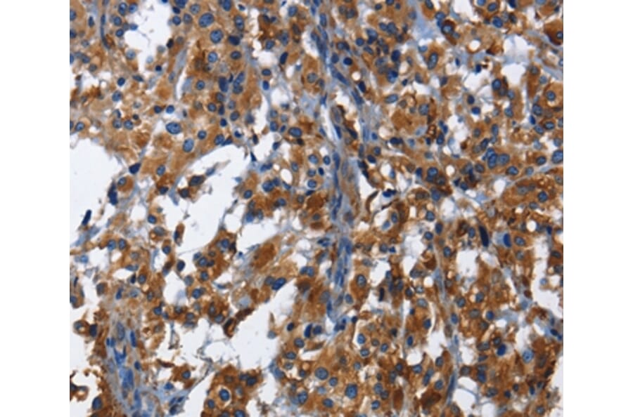 Immunohistochemistry - KLRB1 Antibody from Signalway Antibody (36323) - Antibodies.com