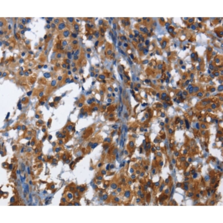 Immunohistochemistry - KLRB1 Antibody from Signalway Antibody (36323) - Antibodies.com