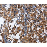 Immunohistochemistry - KLRB1 Antibody from Signalway Antibody (36323) - Antibodies.com