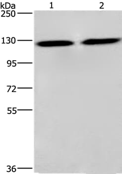 Gel: 6%SDS-PAGE Lysates (from left to right): PC3 and lovo cell Amount of lysate: 40ug per lane Primary antibody: 1/750 dilution Secondary antibody dilution: 1/8000 Exposure time: 3 seconds