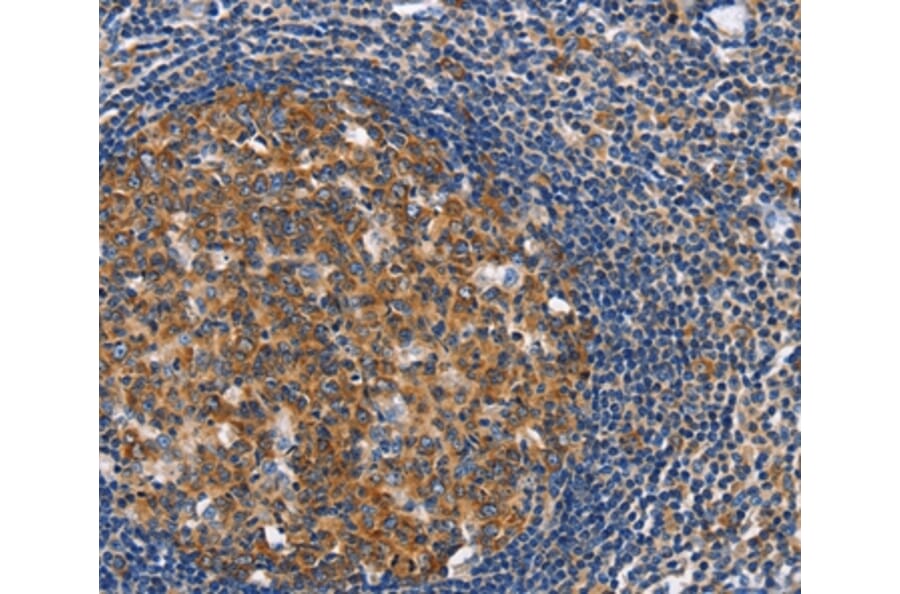 Immunohistochemistry - CEP97 Antibody from Signalway Antibody (36345) - Antibodies.com