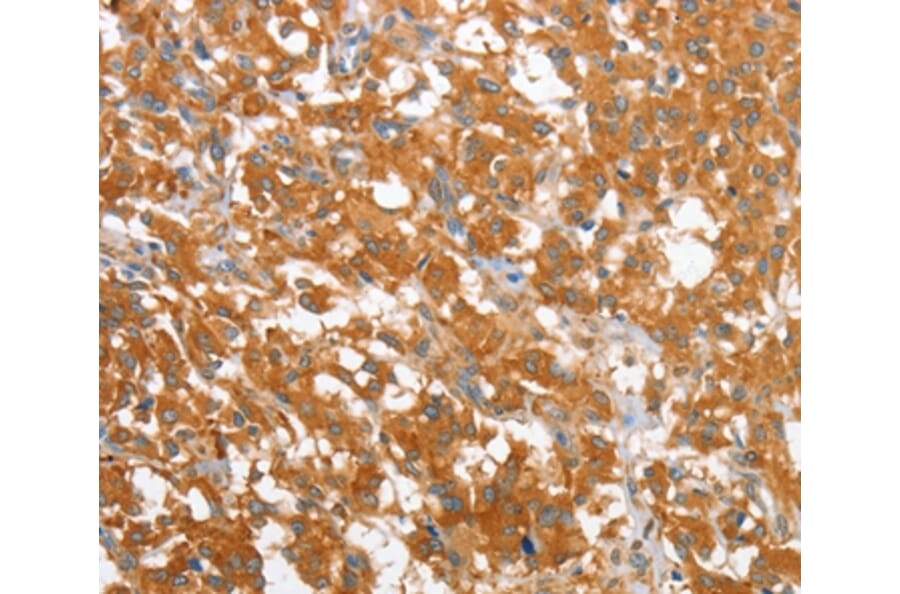 Immunohistochemistry - WNT3A Antibody from Signalway Antibody (36351) - Antibodies.com