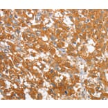 Immunohistochemistry - WNT3A Antibody from Signalway Antibody (36351) - Antibodies.com