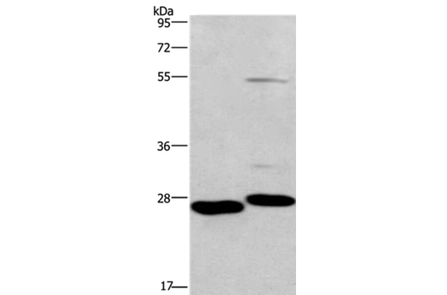 CIDEC Antibody from Signalway Antibody (36353) - Antibodies.com
