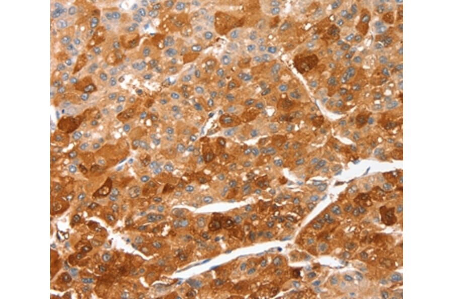 Immunohistochemistry - CIDEC Antibody from Signalway Antibody (36353) - Antibodies.com