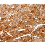 Immunohistochemistry - CIDEC Antibody from Signalway Antibody (36353) - Antibodies.com