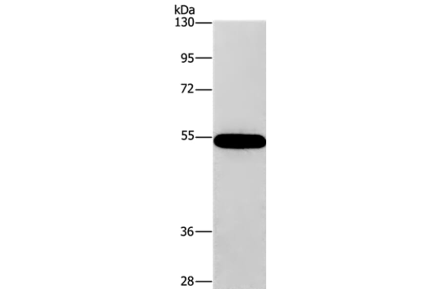 CNDP1 Antibody from Signalway Antibody (36359) - Antibodies.com
