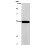 CNDP1 Antibody from Signalway Antibody (36359) - Antibodies.com