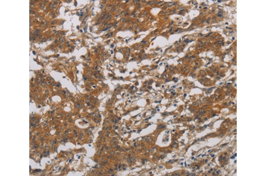 Immunohistochemistry - CNDP1 Antibody from Signalway Antibody (36359) - Antibodies.com