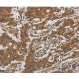 Immunohistochemistry - CNDP1 Antibody from Signalway Antibody (36359) - Antibodies.com