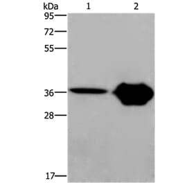 CXCR6 Antibody from Signalway Antibody (36380) - Antibodies.com