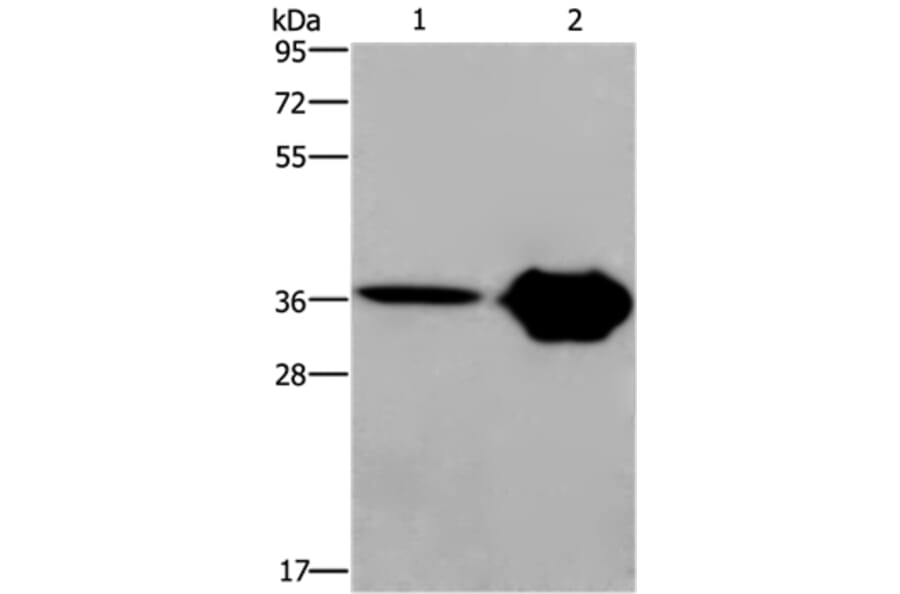CXCR6 Antibody from Signalway Antibody (36380) - Antibodies.com