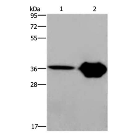 CXCR6 Antibody from Signalway Antibody (36380) - Antibodies.com