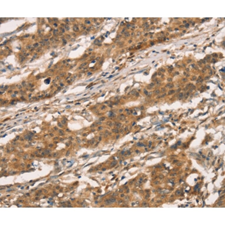 Immunohistochemistry - CXCR6 Antibody from Signalway Antibody (36380) - Antibodies.com