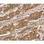 Immunohistochemistry - CXCR6 Antibody from Signalway Antibody (36380) - Antibodies.com