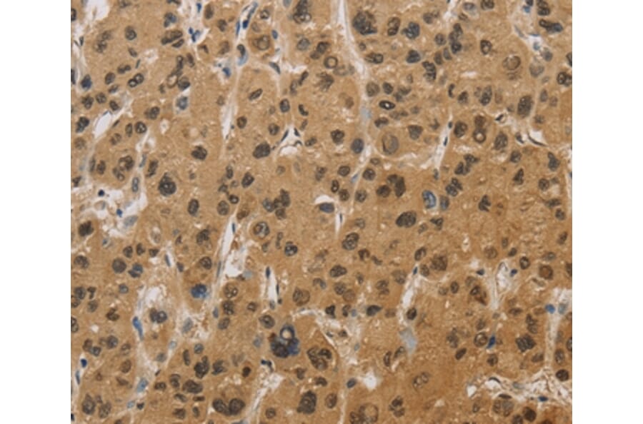 Immunohistochemistry - HSPA4 Antibody from Signalway Antibody (36390) - Antibodies.com