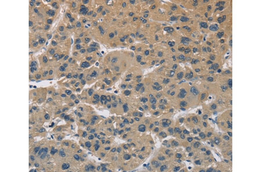 Immunohistochemistry - CYR61 Antibody from Signalway Antibody (36392) - Antibodies.com