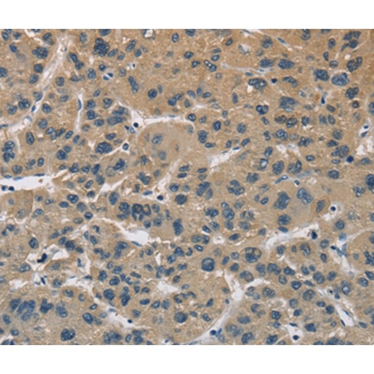 Immunohistochemistry - CYR61 Antibody from Signalway Antibody (36392) - Antibodies.com