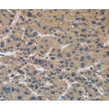 Immunohistochemistry - CYR61 Antibody from Signalway Antibody (36392) - Antibodies.com