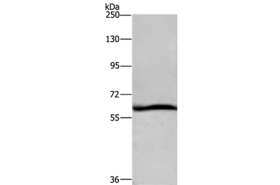 DCP1A Antibody from Signalway Antibody (36402) - Antibodies.com