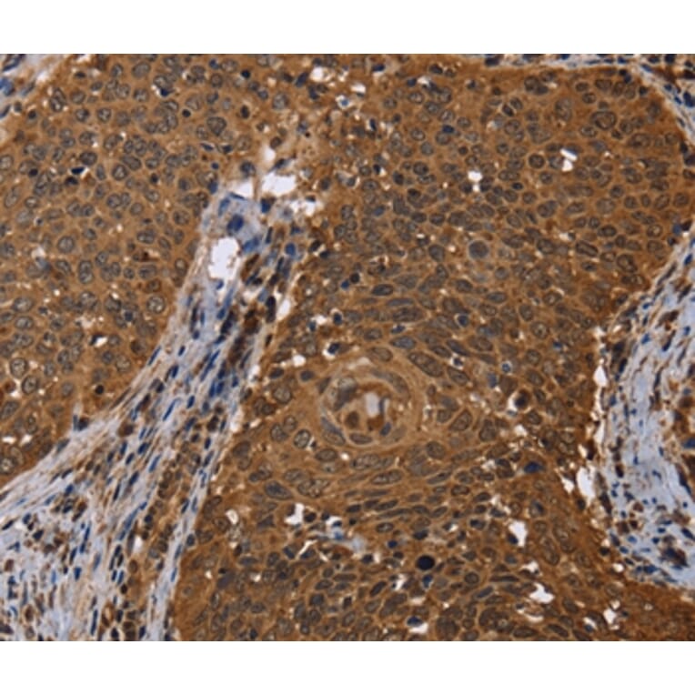 Immunohistochemistry - DCP1A Antibody from Signalway Antibody (36402) - Antibodies.com