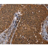 Immunohistochemistry - DCP1A Antibody from Signalway Antibody (36402) - Antibodies.com