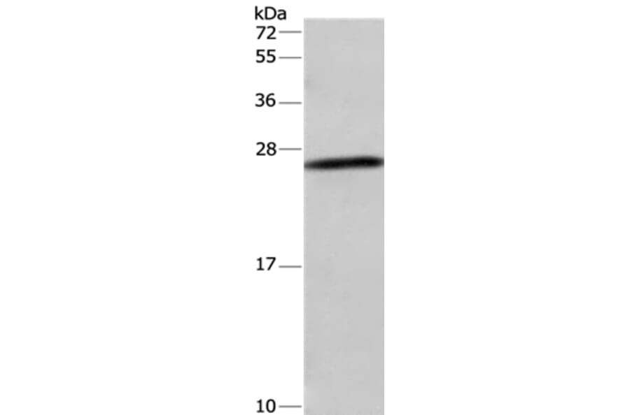 DCTN6 Antibody from Signalway Antibody (36406) - Antibodies.com