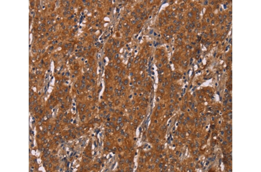 Immunohistochemistry - DCTN6 Antibody from Signalway Antibody (36406) - Antibodies.com