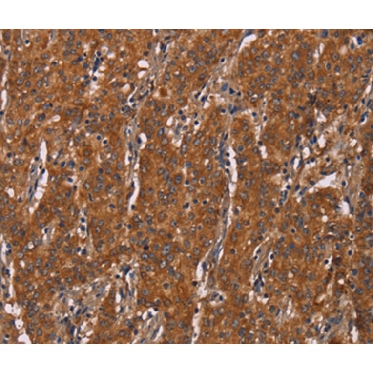 Immunohistochemistry - DCTN6 Antibody from Signalway Antibody (36406) - Antibodies.com