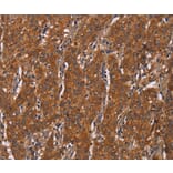 Immunohistochemistry - DCTN6 Antibody from Signalway Antibody (36406) - Antibodies.com