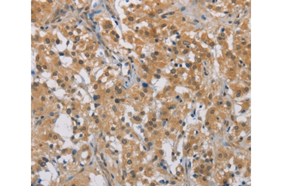 Immunohistochemistry - DDX43 Antibody from Signalway Antibody (36409) - Antibodies.com
