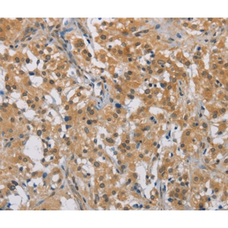 Immunohistochemistry - DDX43 Antibody from Signalway Antibody (36409) - Antibodies.com