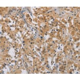 Immunohistochemistry - DDX43 Antibody from Signalway Antibody (36409) - Antibodies.com