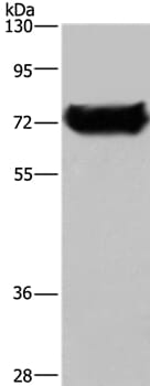 Gel: 8% SDS-PAGE Lysate: 40ug HepG2 cell Primary antibody: 1/200 dilution Secondary antibody dilution: 1/8000 Exposure time: 1 minute