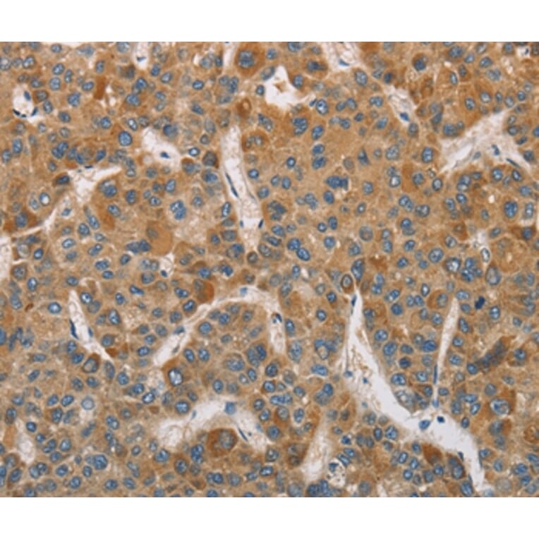 Immunohistochemistry - DDX53 Antibody from Signalway Antibody (36410) - Antibodies.com
