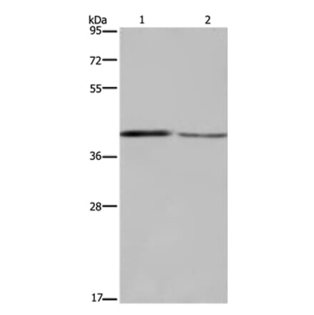 DEGS1 Antibody from Signalway Antibody (36411) - Antibodies.com