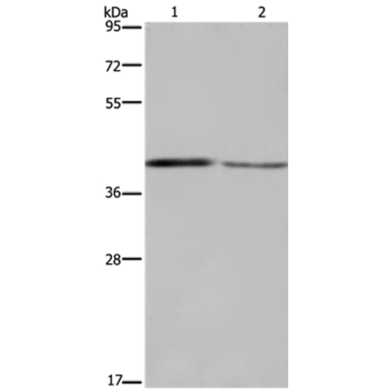 DEGS1 Antibody from Signalway Antibody (36411) - Antibodies.com