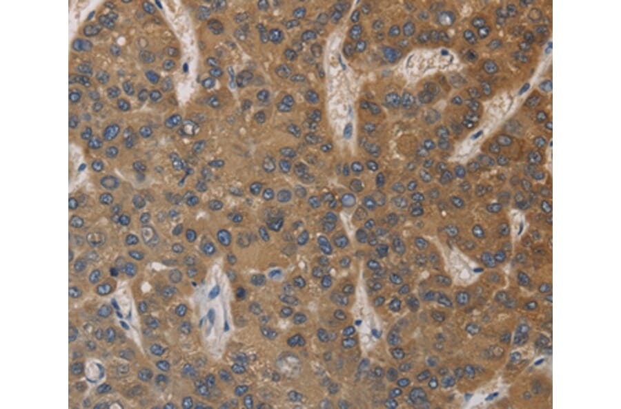 Immunohistochemistry - DEGS1 Antibody from Signalway Antibody (36411) - Antibodies.com